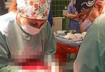 Chirurdzy szpitala w Zielonej Górze wycieli pacjentce guz ważący 42 kg. Był cięższy od kobiety i największy w Polsce